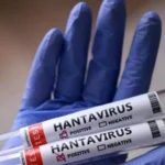 hantavirus
