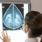Screening oncologici